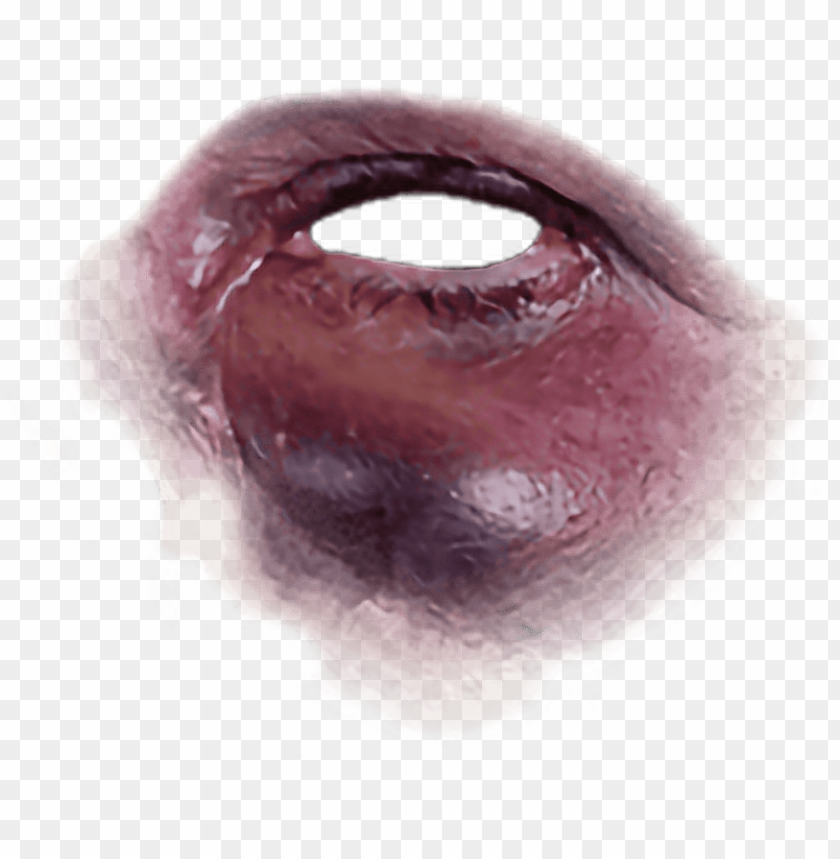 Free download HD PNG black eye bruise PNG transparent with Clear