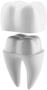 Download illustrated diagram of tooth getting a crown cap - 3d print