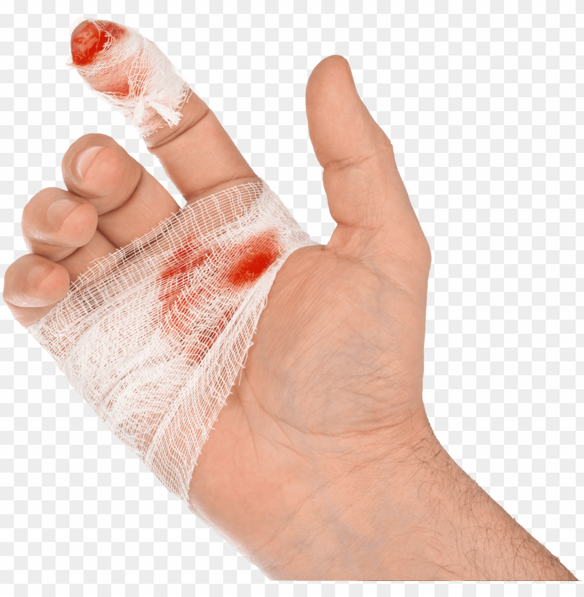 Steel Doctor Blade Injury Cut Hand Blood Png Image With Transparent Background Toppng