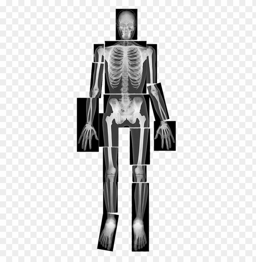 x-ray of full body PNG image with transparent background@toppng.com