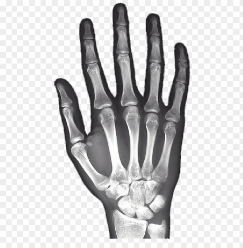 X-ray Of Hand PNG Image With Transparent Background