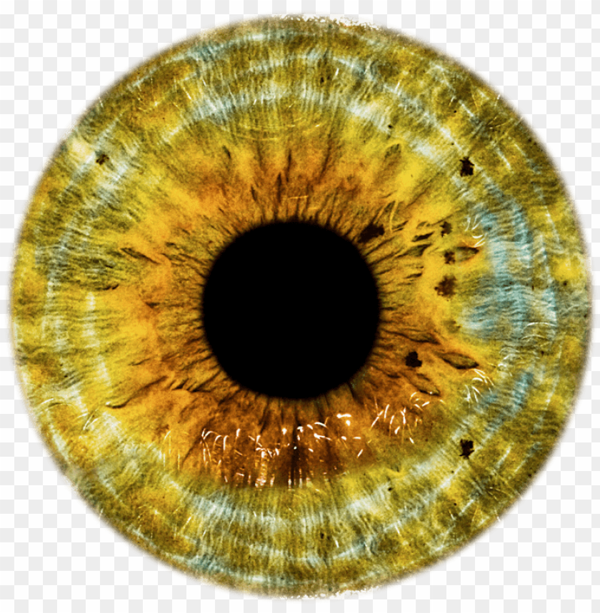 raised yellow spots on eyeballs clipart